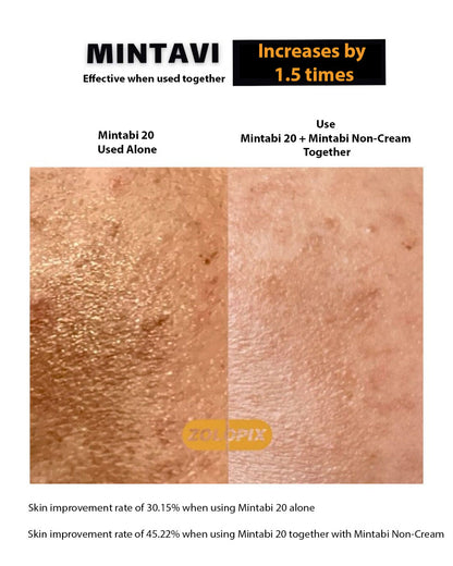 [Pharmesthetic] Zolopix Mintavi Superboost Kit