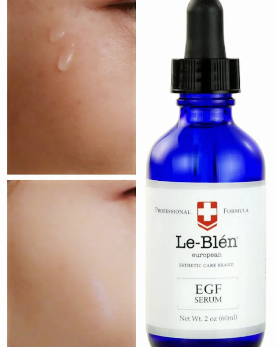 [Le Blen] EGF (Epidermal Growth Factor) Serum ( 4oz)  buy one 4 oz get two 1 oz