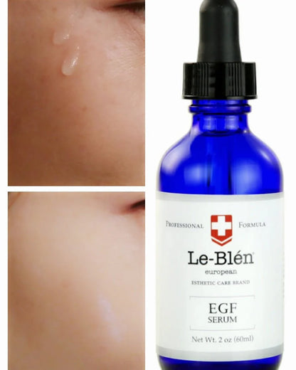 [Le Blen] EGF (Epidermal Growth Factor) Serum ( 4oz)  buy one 4 oz get two 1 oz
